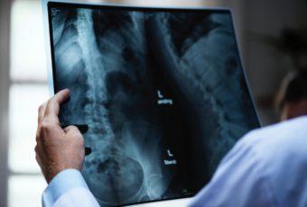 doctor looking at x-ray